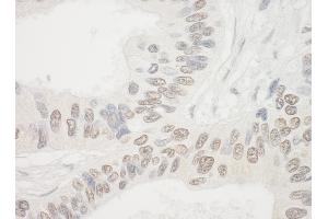 Immunohistochemistry (IHC) image for anti-Nucleolar Protein 10 (NOL10) (AA 638-688) antibody (ABIN7453540) (NOL10 antibody  (AA 638-688))