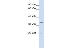WB Suggested Anti-INMT Antibody Titration:  0. (INMT antibody  (N-Term))