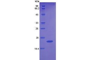 Rabbit Detection antibody from the kit in WB with Positive Control: Sample Human K562 cell lysate.
