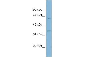 WB Suggested Anti-OSGEP Antibody Titration: 0. (OSGEP antibody  (Middle Region))