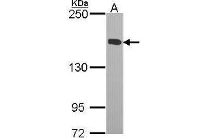 WB Image Sample (30 ug of whole cell lysate) A: H1299 5% SDS PAGE antibody diluted at 1:1000 (KIF4A antibody  (C-Term))