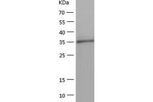 Western Blotting (WB) image for Methenyltetrahydrofolate Synthetase Domain Containing (MTHFSD) (AA 1-383) protein (His tag) (ABIN7287408) (MTHFSD Protein (AA 1-383) (His tag))