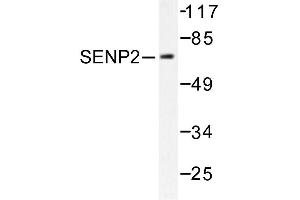 Image no. 1 for anti-SUMO1/sentrin/SMT3 Specific Peptidase 2 (SENP2) antibody (ABIN271956) (SENP2 antibody)