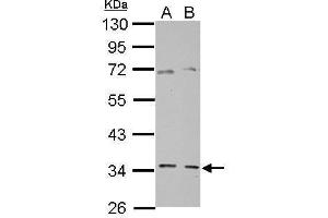 WB Image Sample (30 ug of whole cell lysate) A: PC-3 B: SK-N-SH 10% SDS PAGE antibody diluted at 1:10000 (GGPS1 antibody)