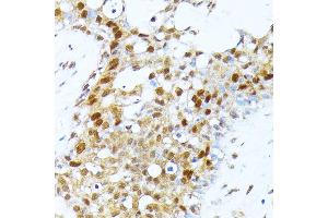 Immunohistochemistry (IHC) image for anti-Protein Arginine Methyltransferase 1 (PRMT1) (AA 20-353) antibody (ABIN3021312)