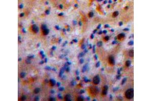 IHC-P analysis of Liver tissue, with DAB staining. (MBL2 antibody  (AA 130-248))