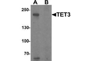 Western blot analysis of TET3 in SK-N-SH cell lysate with TET3 Antibody  at 1 μg/ml in (A) the absence and (B) the presence of blocking peptide
