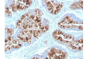Formalin-fixed, paraffin-embedded human Colon stained with MUC1 Rabbit Recombinant Monoclonal Antibody (MUC1/2818R). (Recombinant MUC1 antibody)