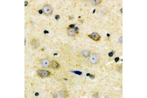 Immunohistochemical analysis of Cyclin D2 staining in human brain formalin fixed paraffin embedded tissue section. (Cyclin D2 antibody)