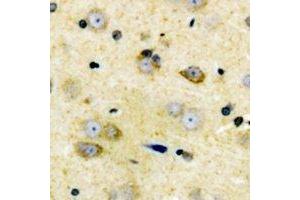 Immunohistochemical analysis of Cyclin D2 staining in human brain formalin fixed paraffin embedded tissue section.