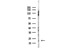 anti-Claudin 6 (CLDN6) (Internal Region) antibody
