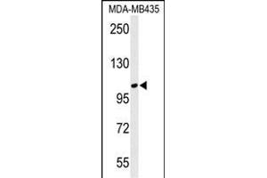 Western blot analysis of LUZP1 Antibody (C-term) (ABIN650909 and ABIN2839991) in MDA-M cell line lysates (35 μg/lane). (LUZP1 antibody  (C-Term))