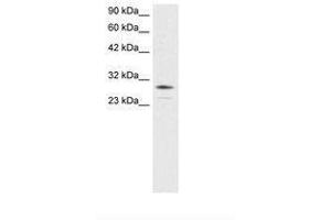 Image no. 3 for anti-Orthodenticle Homeobox 2 (OTX2) (AA 86-135) antibody (ABIN6735803) (OTX2 antibody  (AA 86-135))