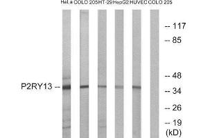 Western Blotting (WB) image for anti-Purinergic Receptor P2Y, G-Protein Coupled, 13 (P2RY13) (Internal Region) antibody (ABIN1853312) (Purinergic Receptor P2Y, G-Protein Coupled, 13 (P2RY13) (Internal Region) antibody)