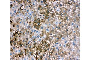 Anti-liver FABP antibody,  IHC(P) IHC(P): Rat Liver Tissue (FABP1 antibody  (N-Term))
