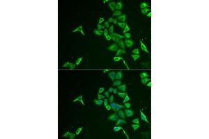 Immunofluorescence analysis of U2OS cells using INPP5J antibody (ABIN6132490, ABIN6142471, ABIN6142472 and ABIN6222324). (INPP5J antibody  (AA 60-360))