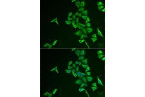 Immunofluorescence analysis of U2OS cells using INPP5J antibody (ABIN6132490, ABIN6142471, ABIN6142472 and ABIN6222324). (INPP5J antibody  (AA 60-360))