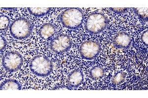Immunohistochemistry (IHC) image for anti-Colony Stimulating Factor 3 Receptor (Granulocyte) (CSF3R) (AA 26-138) antibody (ABIN7437143)