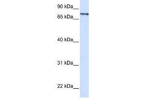 WB Suggested Anti-ZNF180 Antibody Titration:  0. (ZNF180 antibody  (Middle Region))