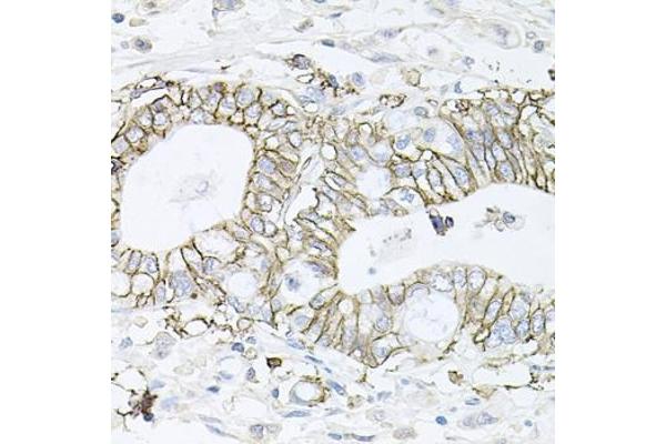 ATP1B1 antibody  (AA 63-303)