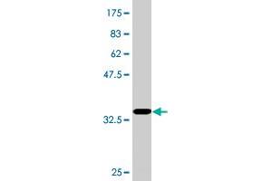 Western Blot detection against Immunogen (36. (RPRD1A antibody  (AA 76-170))