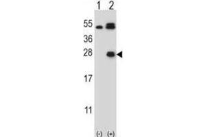 Western Blotting (WB) image for anti-Kallikrein 6 (KLK6) antibody (ABIN5022442) (Kallikrein 6 antibody)
