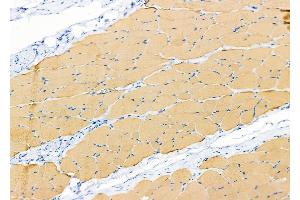 ABIN6265412 and ABIN6279864 at 1/100 staining Rat skin tissue by IHC-P. (SYT10 antibody  (C-Term))