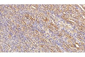 Immunohistochemistry (IHC) image for anti-Heat Shock Protein 90kDa alpha (Cytosolic), Class A Member 1 (HSP90AA1) (AA 698-732) antibody (ABIN7443815)