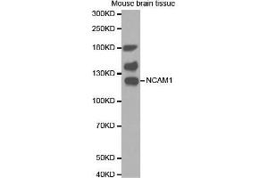Western Blotting (WB) image for anti-Neural Cell Adhesion Molecule 1 (NCAM1) antibody (ABIN1679098) (CD56 antibody)