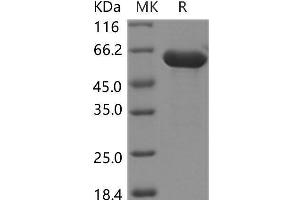 Western Blotting (WB) image for Hexosaminidase B (Beta Polypeptide) (HEXB) protein (His tag) (ABIN7320023) (HEXB Protein (His tag))