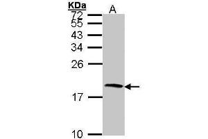 WB Image Sample (30 ug of whole cell lysate) A: Hep G2 , 15% SDS PAGE antibody diluted at 1:1000 (CST4 antibody  (N-Term))