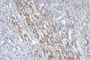 IHC analysis of CD46 using anti-CD46 antibody (ABIN7602758). (CD46 antibody  (C-Term))