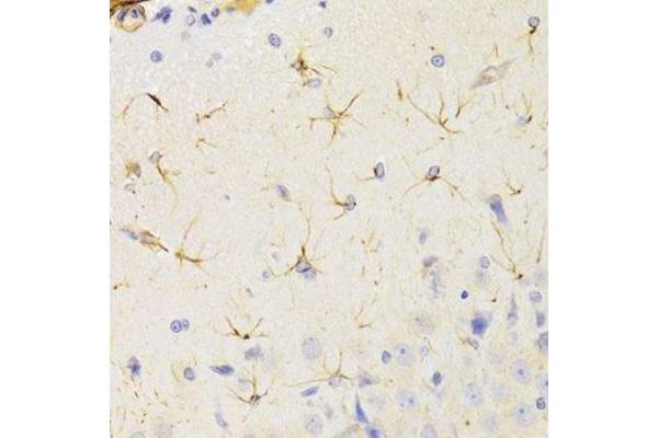 KIF1B antibody  (AA 1501-1770)