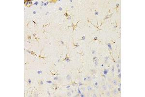 Immunohistochemistry of paraffin-embedded rat brain using KIF1B Antibody.