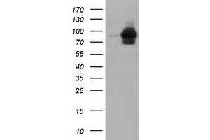 HEK293T cells were transfected with the pCMV6-ENTRY control (Left lane) or pCMV6-ENTRY ALDH1L1 (Right lane) cDNA for 48 hrs and lysed. (ALDH1L1 antibody)