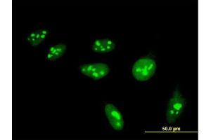 Immunofluorescence of monoclonal antibody to HIST1H4H on HeLa cell. (HIST1H4H antibody  (AA 31-103))