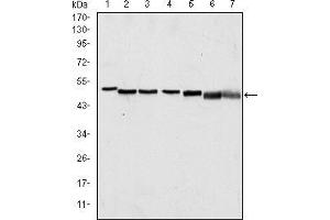 Western blot analysis using p63α mouse mAb against A431 (1), Hela (2), Jurkat (3), THP-1 (4), NIH/3T3 (5), Cos7 (6) and PC-12 (7) cell lysate. (p63alpha antibody)