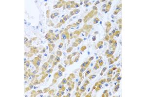 Immunohistochemistry of paraffin-embedded human liver using MANF antibody (ABIN6291535) at dilution of 1:100 (40x lens). (MANF antibody)