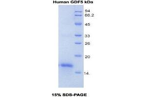SDS-PAGE (SDS) image for Growth Differentiation Factor 5 (GDF5) (AA 382-501) protein (His tag) (ABIN1079764)