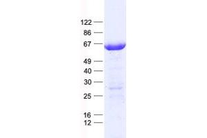 Validation with Western Blot (ALPL Protein (His tag))
