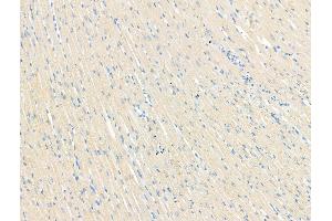 ABIN7094526 and ABIN7098575 at 1/100 staining Rat heart tissue by IHC-P.