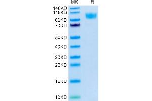 Human CD45 on Tris-Bis PAGE under reduced condition. (CD45 Protein (AA 26-416) (His-Avi Tag))