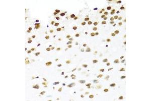 Immunohistochemistry (Paraffin-embedded Sections) (IHC (p)) image for anti-Pre-mRNA Processing Factor 19 (PRPF19) (AA 127-416) antibody (ABIN6146256)
