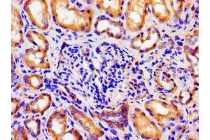 Immunohistochemistry of paraffin-embedded human kidney tissue using ABIN7144647 at dilution of 1:100 (ARTN antibody  (AA 108-220))