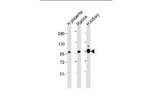 All lanes : Anti-E Antibody (Center) at 1:4000 dilution Lane 1: Human placenta lysate Lane 2: Ramos whole cell lysate Lane 3: Human kidney lysate Lysates/proteins at 20 μg per lane. (MME antibody  (AA 472-505))