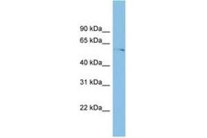 Image no. 1 for anti-Tubulointerstitial Nephritis Antigen-Like 1 (TINAGL1) (AA 215-264) antibody (ABIN6745182) (TINAGL1 antibody  (AA 215-264))