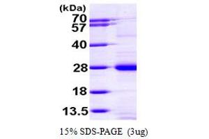 SDS-PAGE (SDS) image for RAP1A, Member of RAS Oncogene Family (RAP1A) (AA 1-181) protein (His tag) (ABIN667792)