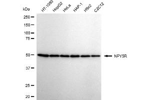 Western blotting analysis using NPY5R antibody (ABIN7799585).