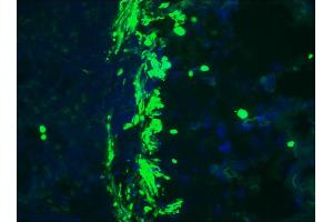 Image no. 2 for anti-Desmin (DES) antibody (ABIN335360) (Desmin antibody)