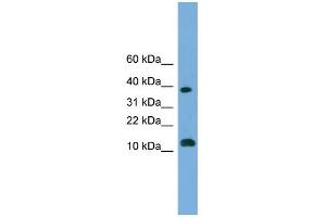WB Suggested Anti-LOC152586 Antibody Titration: 0. (GL54D antibody  (Middle Region))